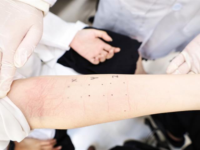 คณะเภสัชศาสตร์จัดการเรียนการสอนภาคปฏิบัติการ ในหัวข้อ “การทดสอบการระคายเคืองต่อผิว (Skin irritation test)”