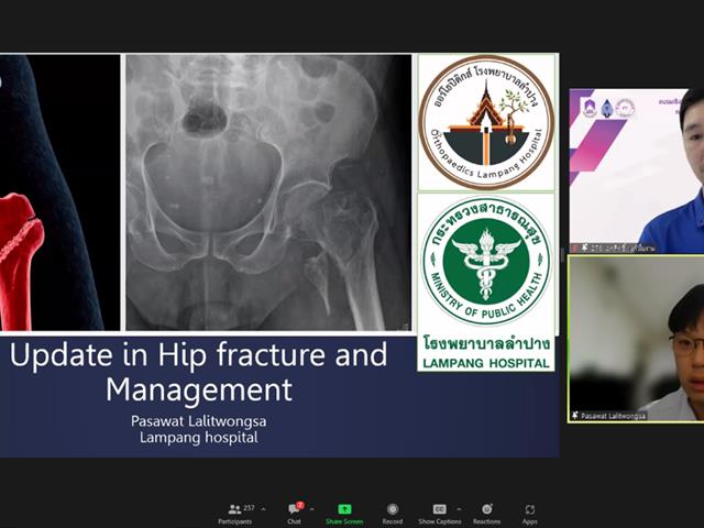 AHS UP join collaboration with Lampang PT network hosted an online event for the topic of “Development of patient care and rehabilitation in pelvis bone fracture and elderly care.”