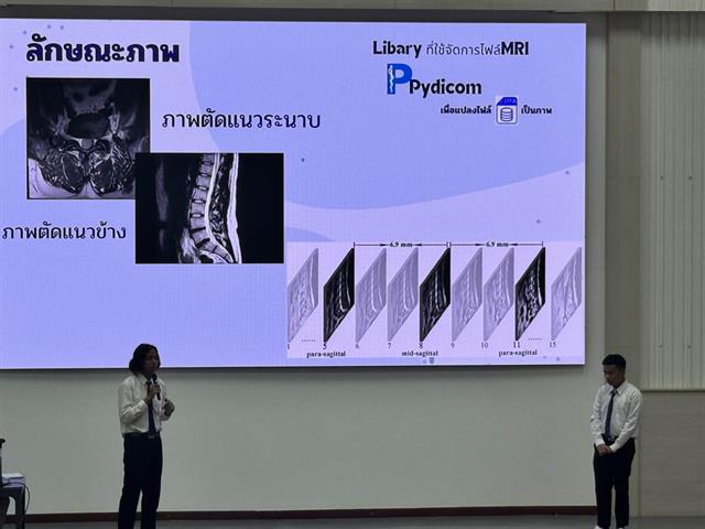  Super AI X Development with AI-Powered Spinal Disc Innovation